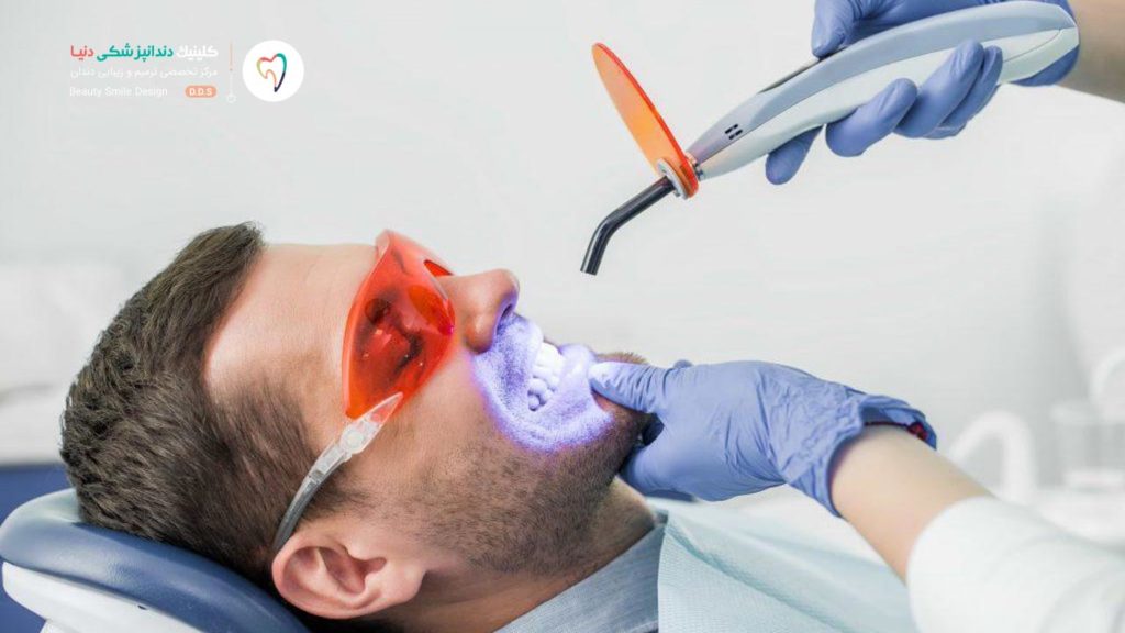 تصویر یک مراجع که روی تخت دندانپزشکی نشسته و دندانپزشک در حال سفید کردن دندان هایش است