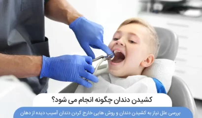 عکس کشیدن دندان