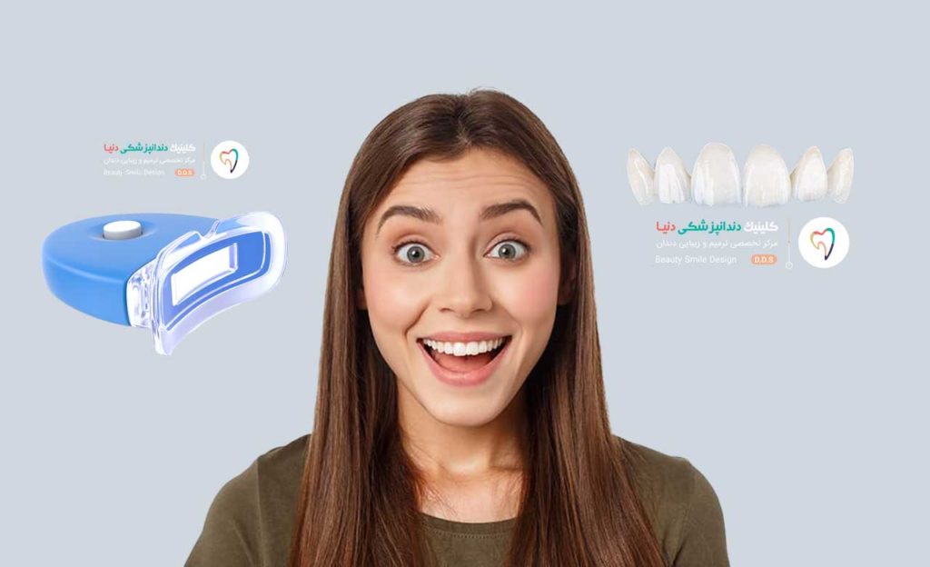 تفاوت لمینت و کامپوزیت و بلیچینگ دندان چیست؟