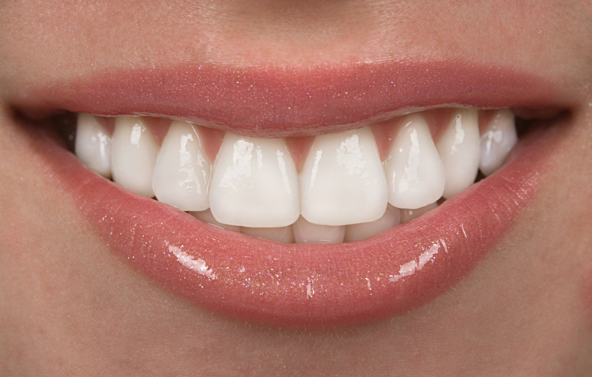 طول عمر لمینت دندان