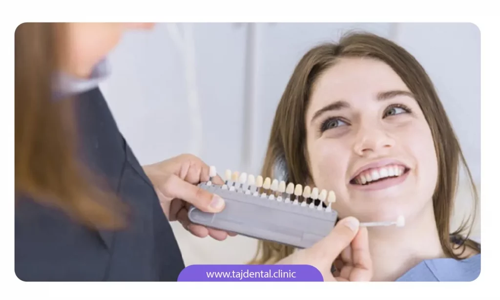دندانپزشک در حال انتخاب رنگ لمینت پیش از تراش دندان برای مشخص کردن سایه رنگ لمینت بیمار
