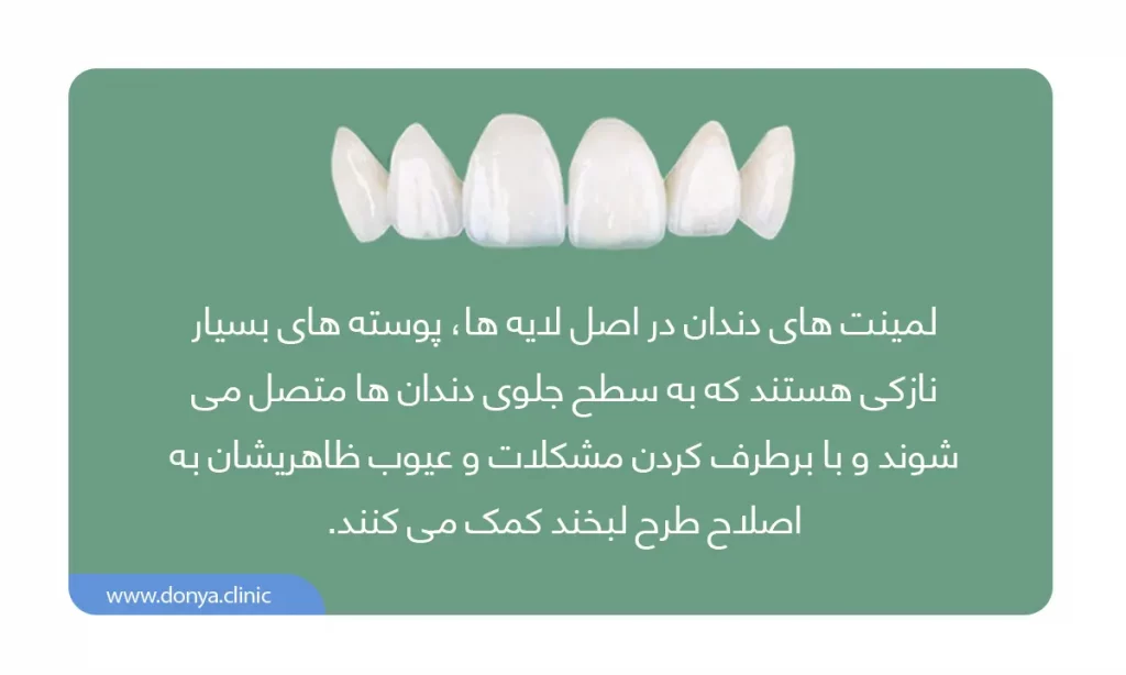 اینفوگرافی تعریف لمینت دندان همراه با تعدادی لمینت دندان جلو
