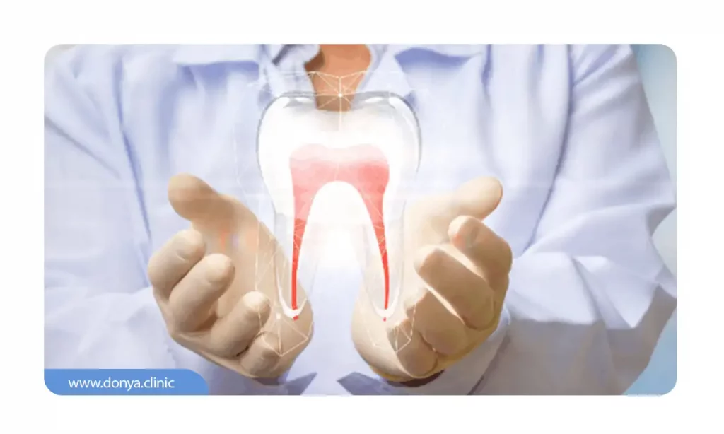 تصویر شماتیک پالپ دندان در دستان یک دندانپزشک