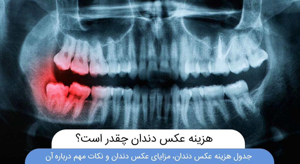 شاخص قیمت و هزینه عکس دندان