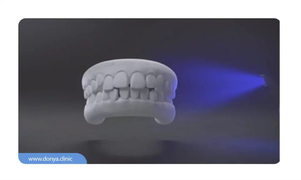 تصویر شماتیک نحوه اسکن دهان و دندان برای ارتودنسی نامرئی