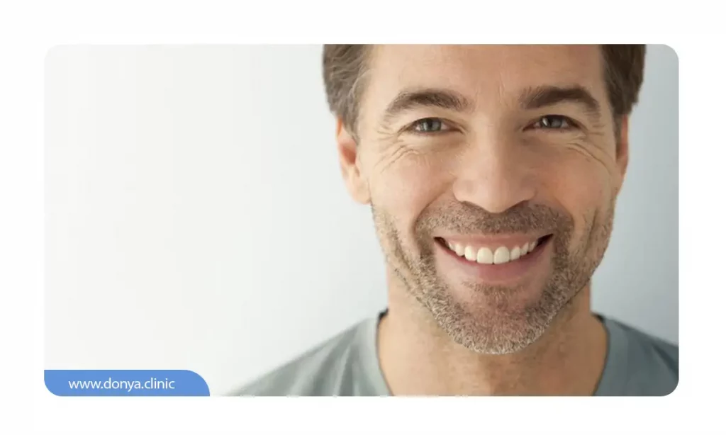 مردی که بعد از گذاشتن ایمپلنت دندان طرح لبخند زیبا و لثه های سالمی دارد