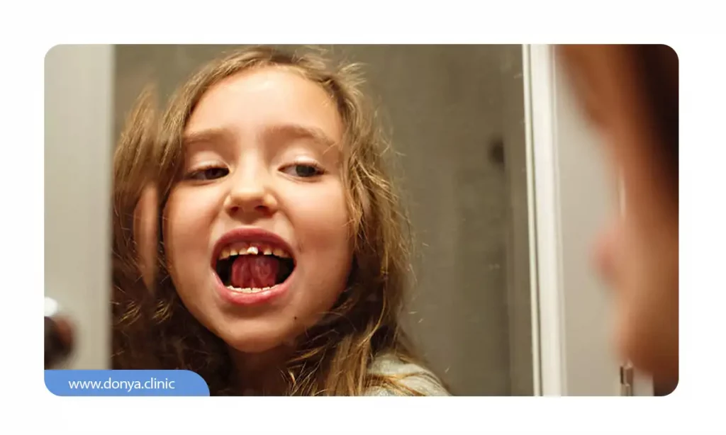 دختربچه ای که در حال بازی کردن با دندان لق شده اش است