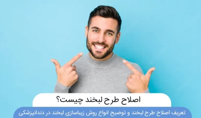 اصلاح طرح لبخند