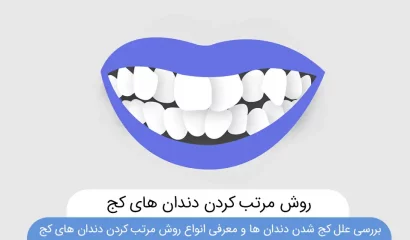 شاخص علت کج شدن دندان ها