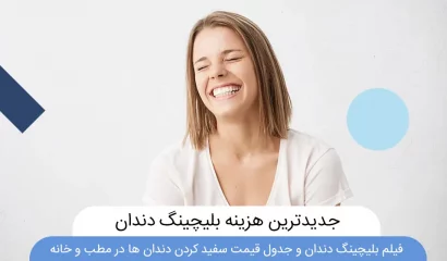 هزینه بلیچینگ دندان در سال 1401 عکس