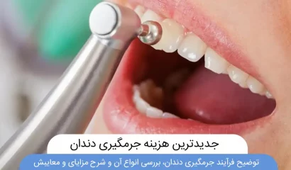 قیمت و هزینه جرمگیری دندان عکس