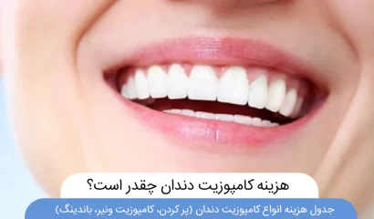 عکس هزینه کامپوزیت دندان