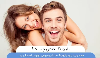 عکس بلیچینگ دندان