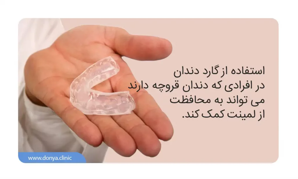 محافظ لمینت دندان