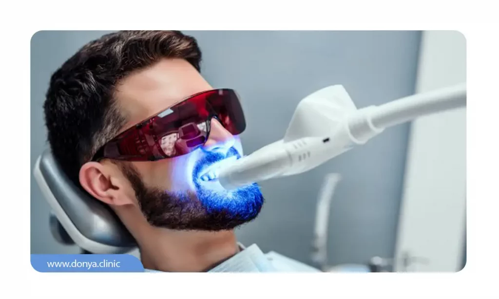 مردی که روی یونیت دندانپزشکی و در حال انجام بلیچینگ دندان است