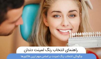 رنگ لمینت دندان عکس