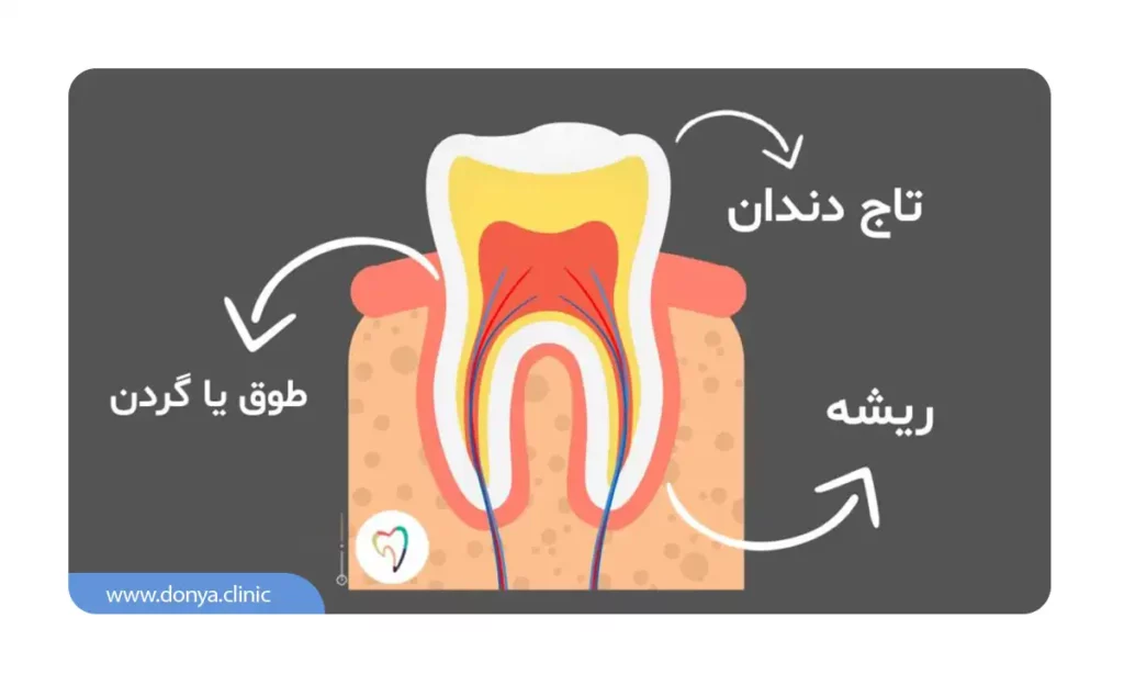 اینفوگرافی معرفی تاج دندان