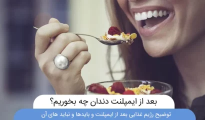 تغذیه بعد از ایمپلنت دندان عکس شاخص