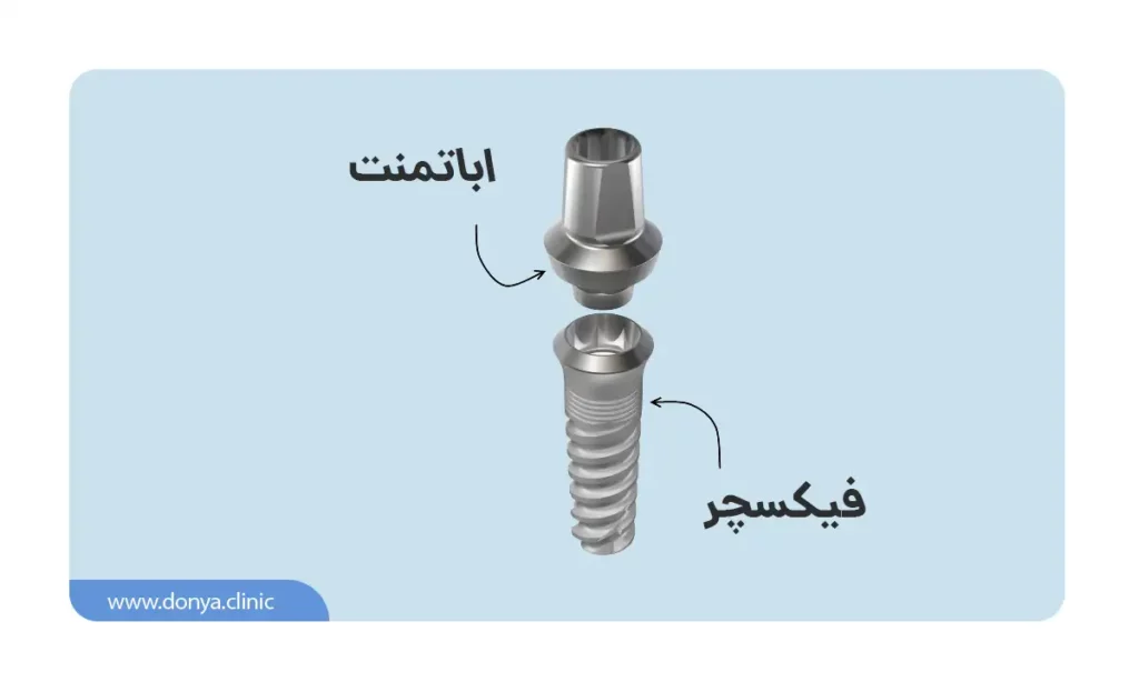 عکس اباتمنت و پایه