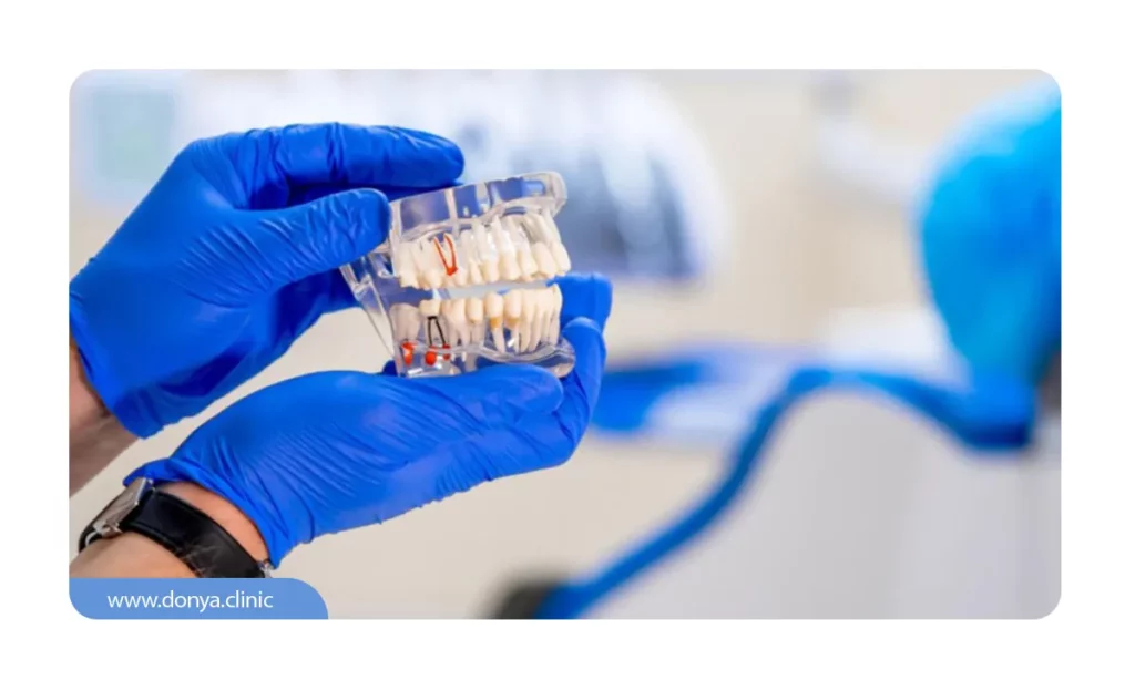 عکسی از نحوه قرارگیری ایمپلنت در قالب مصنوعی دندان ها