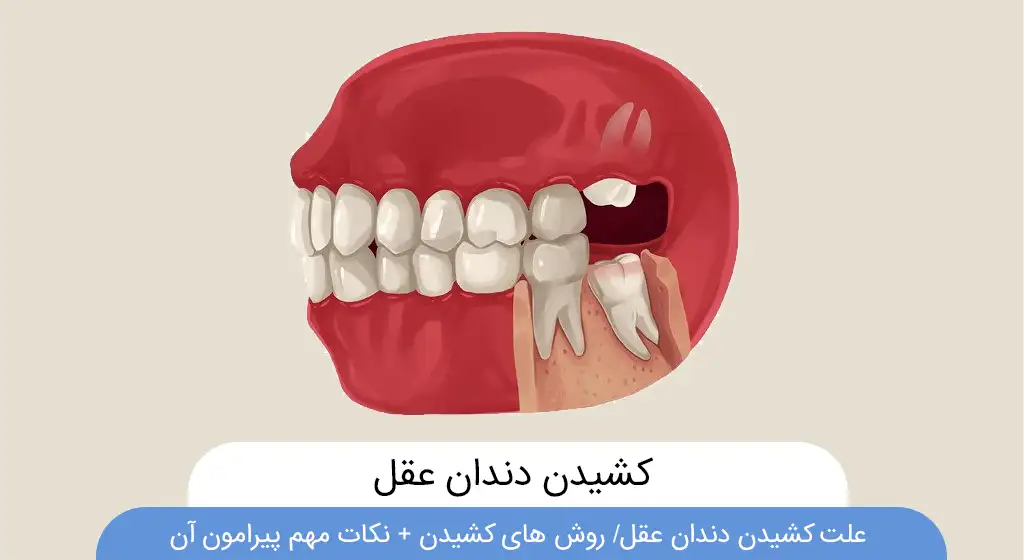 عکس کشیدن دندان عقل شاخص