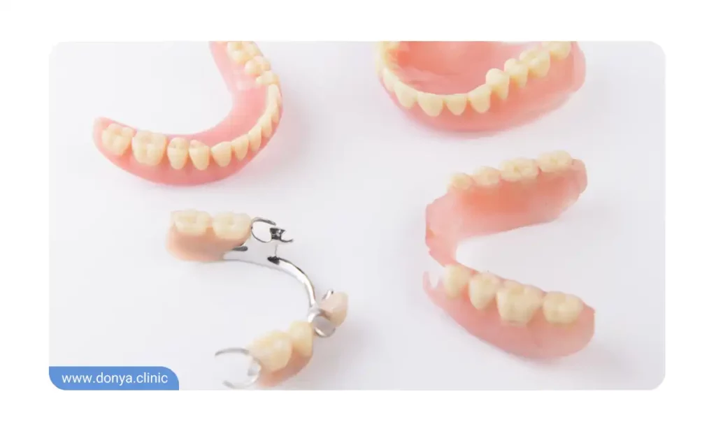 عکس انواع دندان مصنوعی تکه ای و کامل