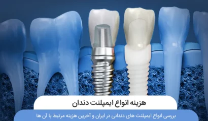 هزینه لمینت دندان