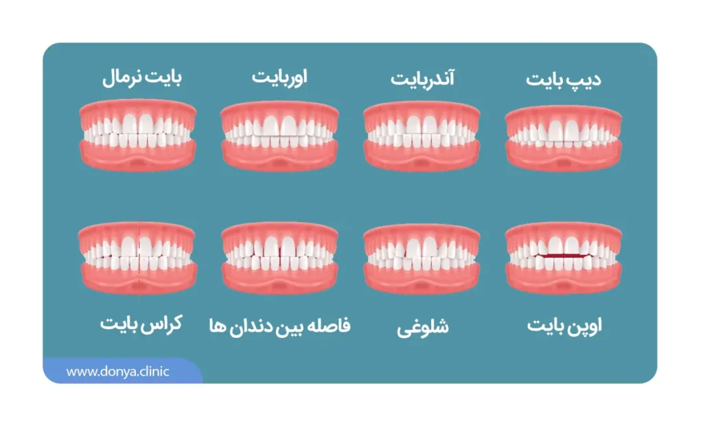 اینفوگرافی: مشکلات رایجی که یک متخصص ارتودنسی برطرف می کند