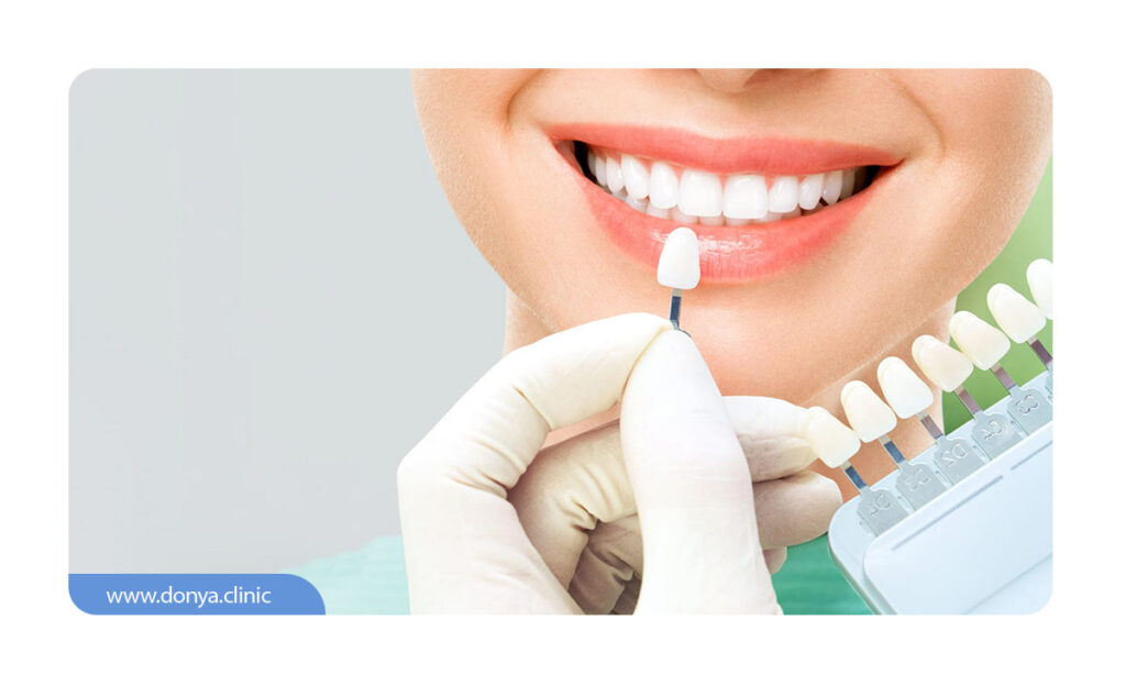 تطابق رنگی میان رنگ لمینت دندان با رنگ پوست متقاضی