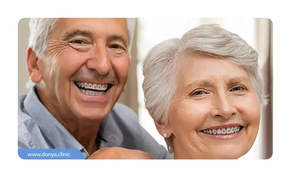 یک مرد و زن مسن با دندان های ارتودنسی شده