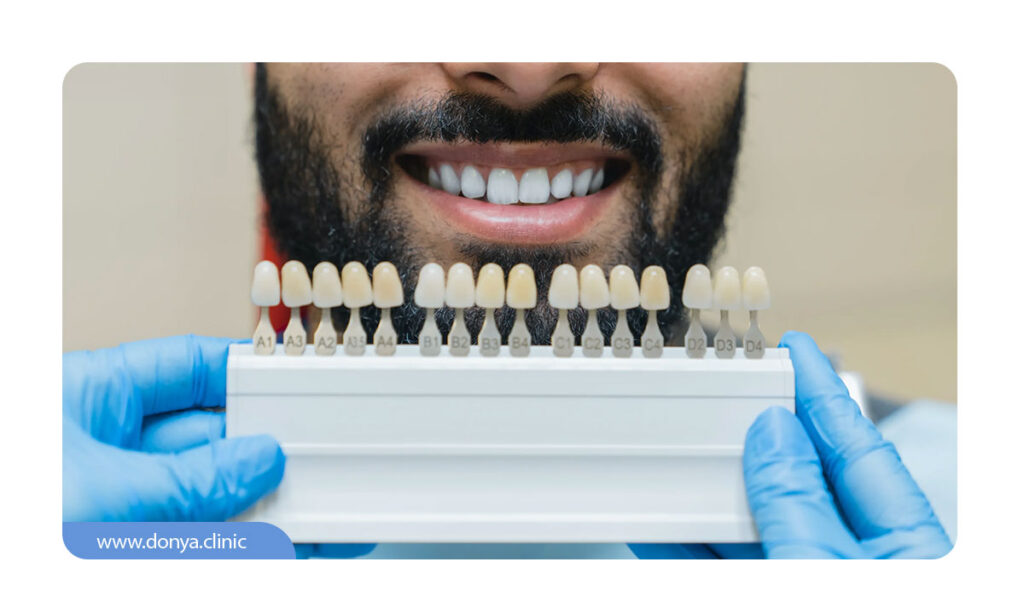 پالت ویتا در دندانپزشکی ترمیمی و زیبایی