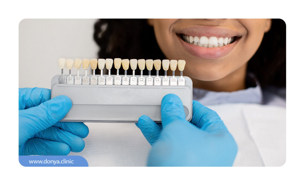 گروه های رنگی سیستم ویتا