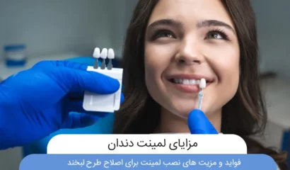 مزایای لمینت دندان