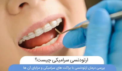 ارتودنسی سرامیکی چیست