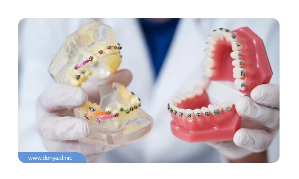 متخصص ارتودنسی پس ار معاینه دندان های شما یک بازه زمانی حدودی برای تغییرات دندان پیش بینی می کند.