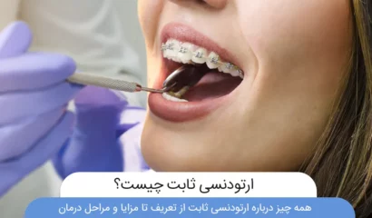 ارتودنسی ثابت عکس