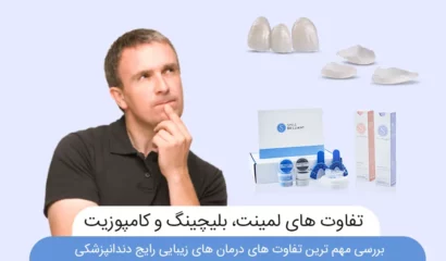 عکس شاخص تفاوت بلیچینگ لمینت و کامپوزیت