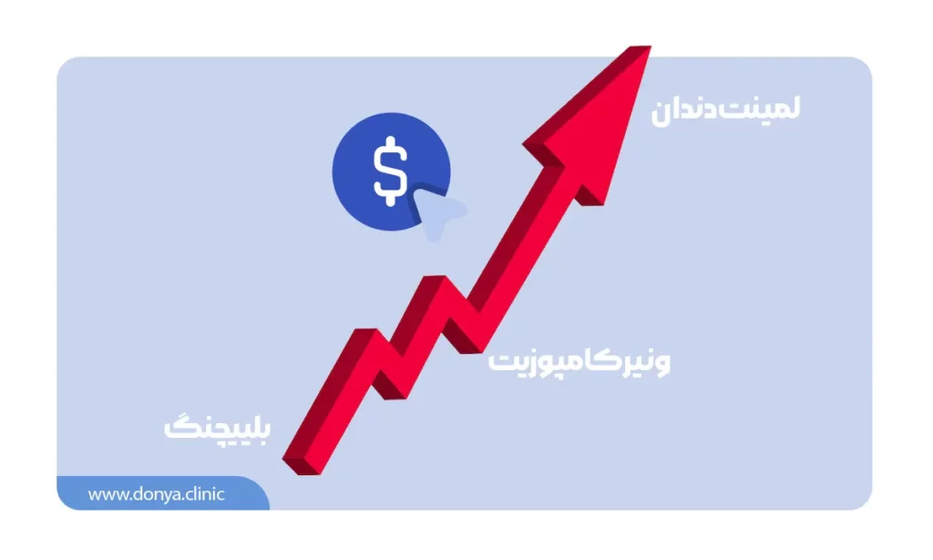 اصلی ترین تفاوت لمینت و کامپوزیت و بلیچینگ دندان در هزینه هریک از آن هاست