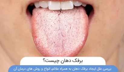 عکس برفک دهان شاخص
