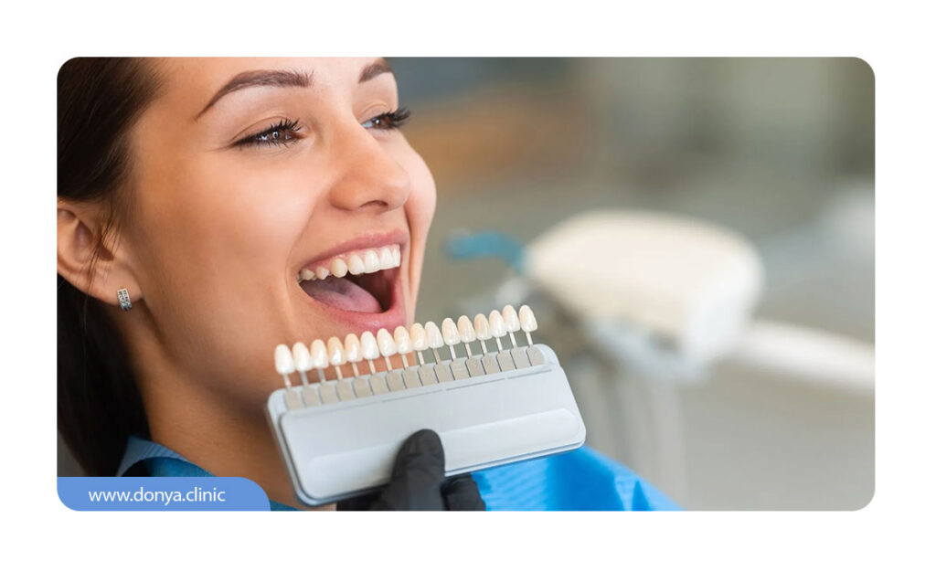 کاندیدای مناسب لمینت دندان کیست؟