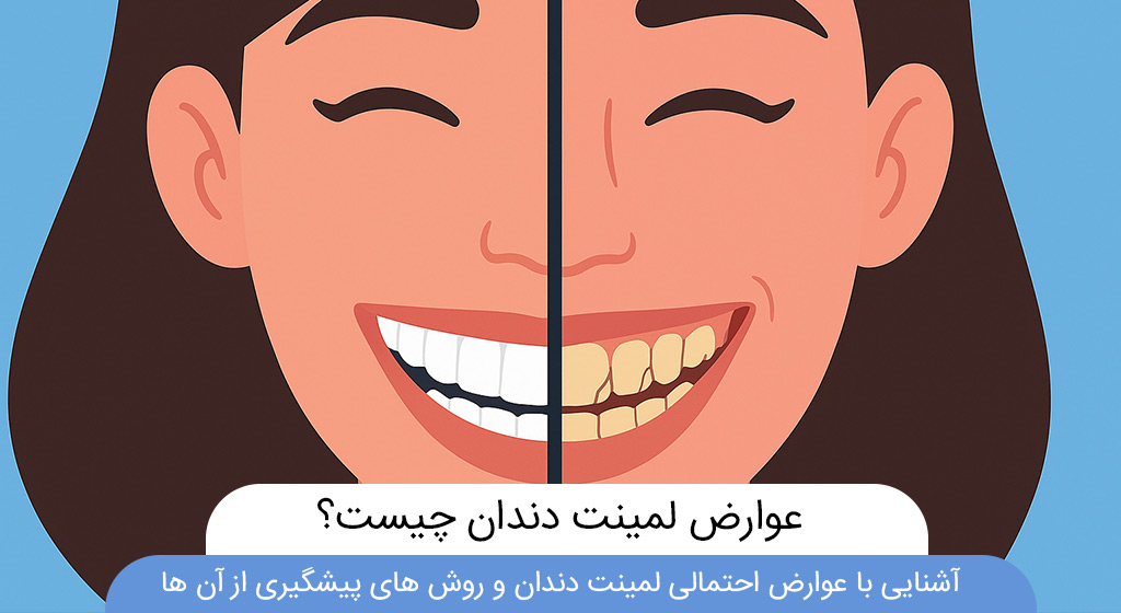 عوارض لمینت دندان