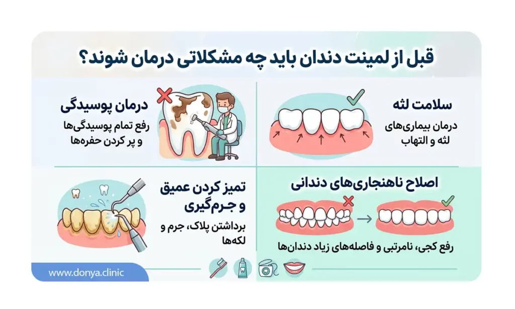 اینفوگرافی قبل از لمینت دندان باید چه مشکلاتی درمان شوند