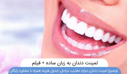 عکس لمینت دندان