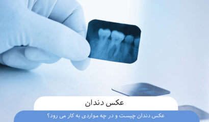 عکس دندان