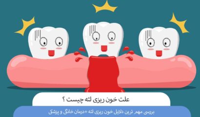 علت خونریزی لثه چیست