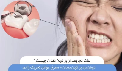 علت درد بعد از پر کردن دندان