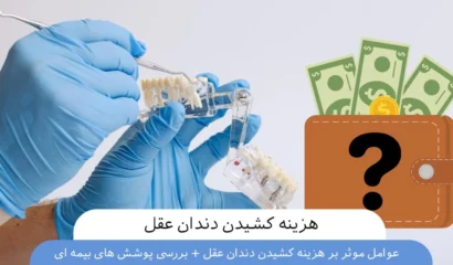 هزینه کشیدن دندان عقل