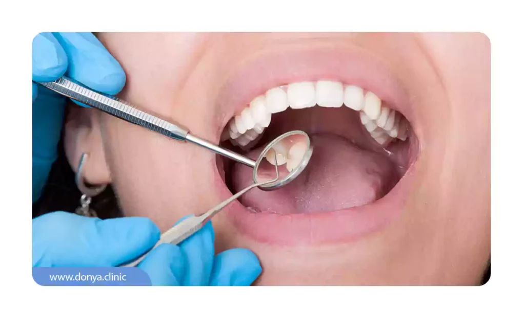 عکسی از ارزیابی وضعیت ایمپلنت دندانی دارای درد