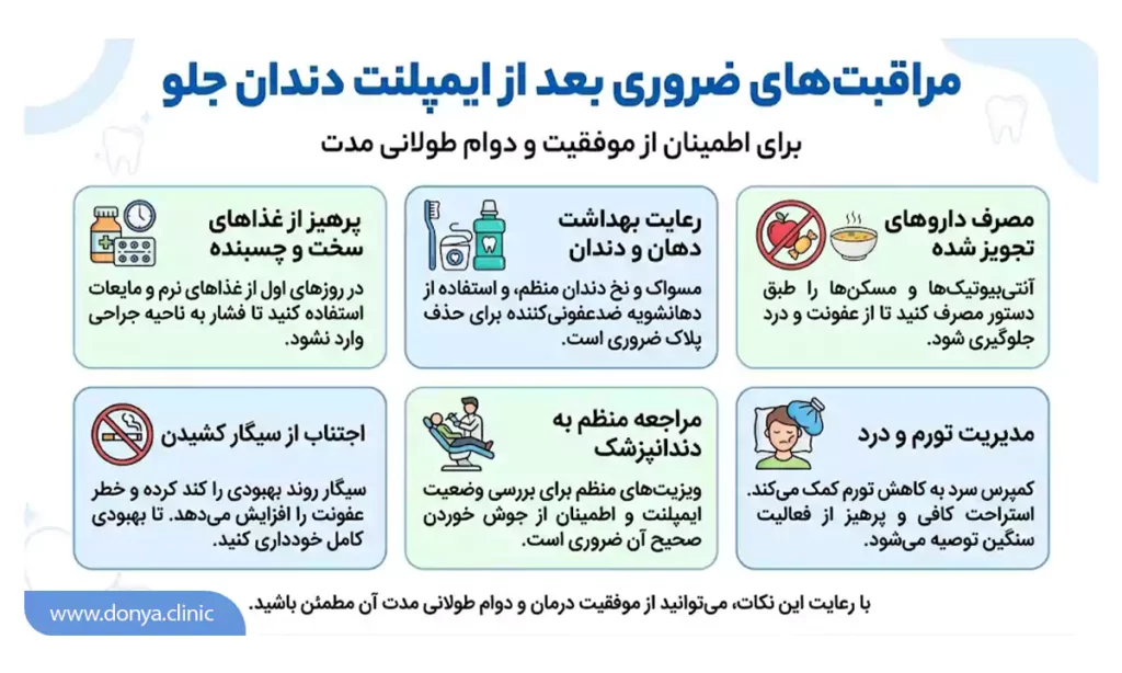 مراقبت های بعد از ایمپلنت دندان جلو