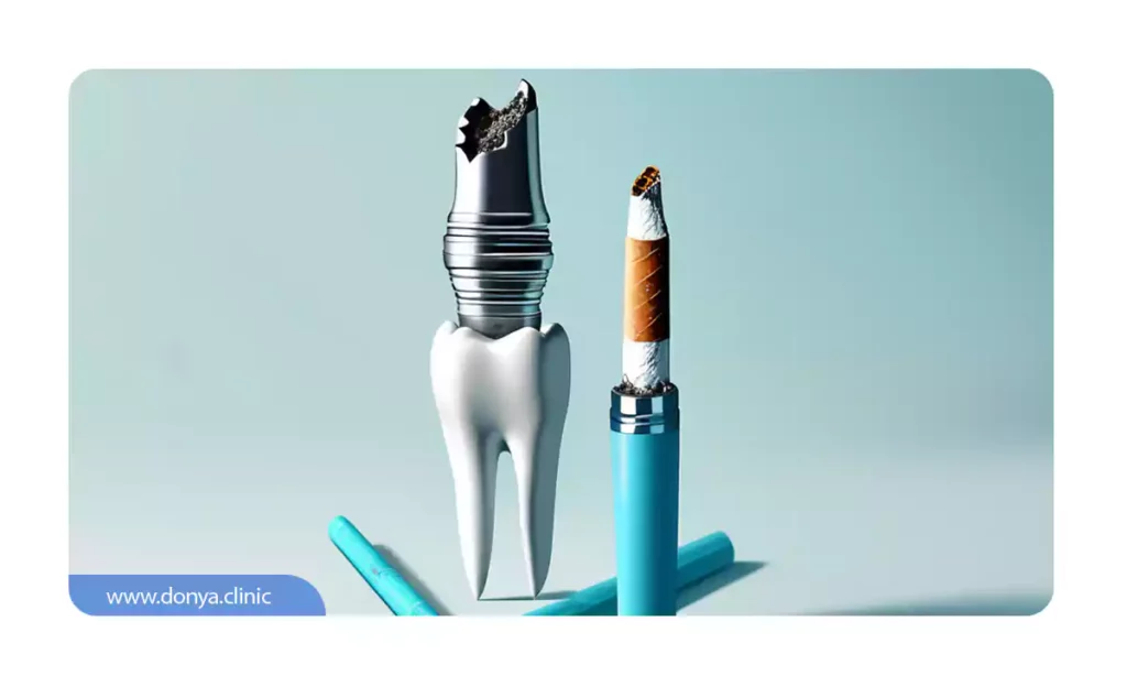 تا چند روز بعد از جراحی ایمپلنت نباید سیگار کشید؟